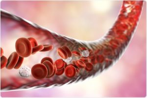 Study Explores Role Of HDAC9 Gene In Solidifying Of Blood Vessel Walls